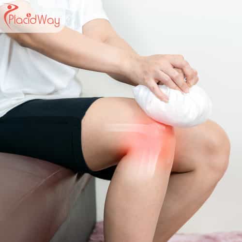 Stem Cell Therapy for Osteoarthritis in Turkey: Costs and Options for UK Patients